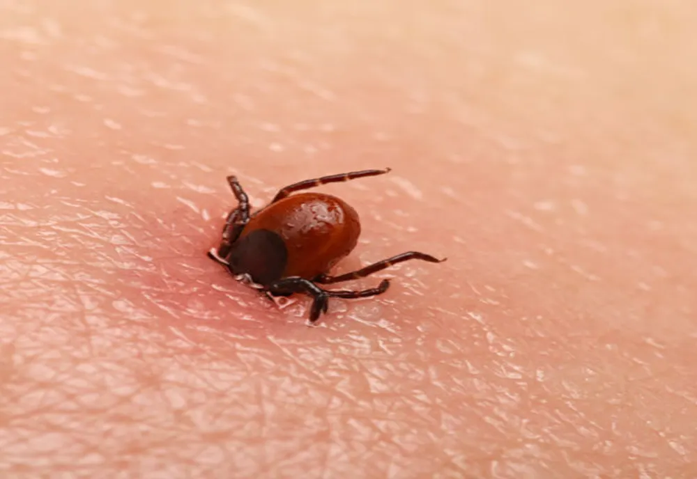 Zeci de români au fost muşcaţi de căpuşe. Care sunt recomandările medicilor