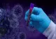 Bilanț coronavirus: 3.114 cazuri noi de COVID-19, înregistrate în ultimele 24 de ore